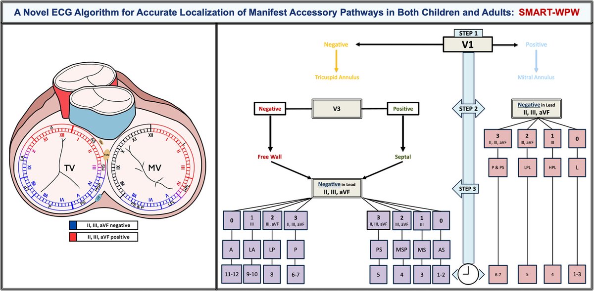 The Heart (@zheart11768530) on Twitter photo 🔴A Novel ECG Algorithm for Accurate Localization of Manifest Accessory Pathways in Both Children and Adults: SMART-WPW⤵️ <a href="/hrs_journal/">HeartRhythm</a>
🔹The SMART-WPW algorithm is an accurate, efficient, and reproducible tool for 12‐lead ECG-based AP localization.
🔹sciencedirect.com/science/articl… 🔴A Novel ECG Algorithm for Accurate Localization of Manifest Accessory Pathways in Both Children and Adults: SMART-WPW⤵️ <a href="/hrs_journal/">HeartRhythm</a>
🔹The SMART-WPW algorithm is an accurate, efficient, and reproducible tool for 12‐lead ECG-based AP localization.
🔹sciencedirect.com/science/articl…