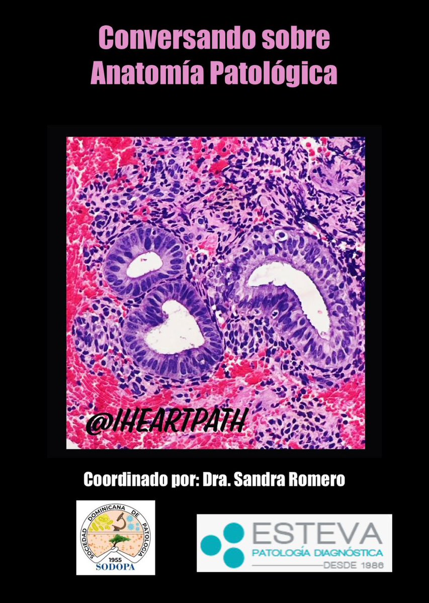 Los invitamos a unirse a la reunión Zoom. Este Jueves 8 mayo de 2025 07:00 PM Caracas

Dra. ANGELICA CUEVAS
CIRUJANO ONCÓLOGO

CÁNCER DE ENDOMETRIO. FUNDAMENTOS PRÁCTICOS DEL PERFIL MOLECULAR Y NUEVA CLASIFICACIÓN DE FIGO.  

Inscríbase en:
us02web.zoom.us/meeting/regist…