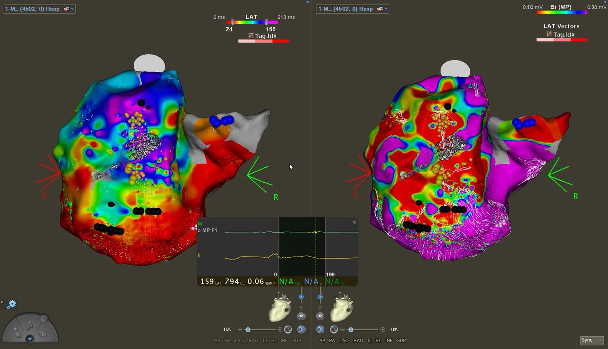 NNUH Cardiac Electrophysiology tweet media