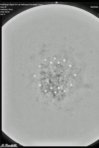 MarioNawfal's tweet image. 🇨🇴 ALIEN BALL DROPS INTO COLOMBIA AND NO ONE KNOWS WHAT IT IS

A weird metal sphere just fell from the sky in Buga, Colombia, and scientists are officially confused.

It’s made of three dense layers, has a chip-like core, and 18 tiny micro-spheres inside—no welds, no seams, and…