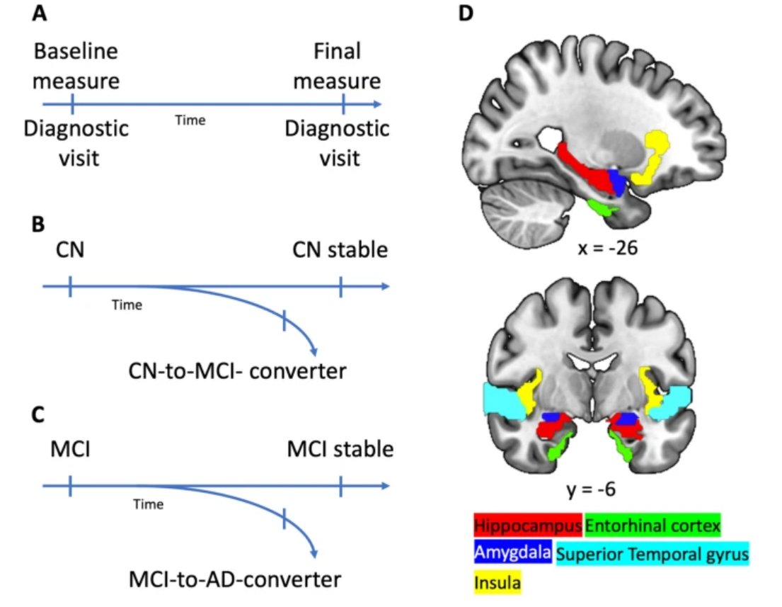 GeroScience (@geroscienceage) on Twitter photo 📢New Open🔓 Access Article
Predicting the progression of MCI and Alzheimer’s disease on structural brain integrity and other features with machine learning by Marthe Mieling, Mushfa Yousuf (<a href="/Mushfa/">Mushfa Yousuf</a>) & Nico Bunzeck for the Alzheimer’s Disease Neuroimaging Initiative. 📢New Open🔓 Access Article
Predicting the progression of MCI and Alzheimer’s disease on structural brain integrity and other features with machine learning by Marthe Mieling, Mushfa Yousuf (<a href="/Mushfa/">Mushfa Yousuf</a>) & Nico Bunzeck for the Alzheimer’s Disease Neuroimaging Initiative.