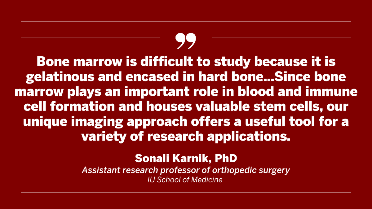Indiana University (@indianauniv) on Twitter photo Researchers at <a href="/IUMedSchool/">IU School of Medicine</a> are shining new light on one of the body’s most complex systems: bone marrow. 🦴
Using a brand-new, innovative imaging technique, researchers can view bone marrow activity with greater detail than ever before, giving insight into immune disorders, Researchers at <a href="/IUMedSchool/">IU School of Medicine</a> are shining new light on one of the body’s most complex systems: bone marrow. 🦴
Using a brand-new, innovative imaging technique, researchers can view bone marrow activity with greater detail than ever before, giving insight into immune disorders,
