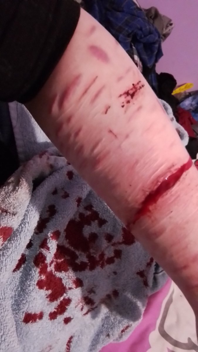 tism_eater's tweet photo. I just hit a vein and my whole are feels numb I'm so cooked 
#shtwt https://t.co/N8DvyQZiGg