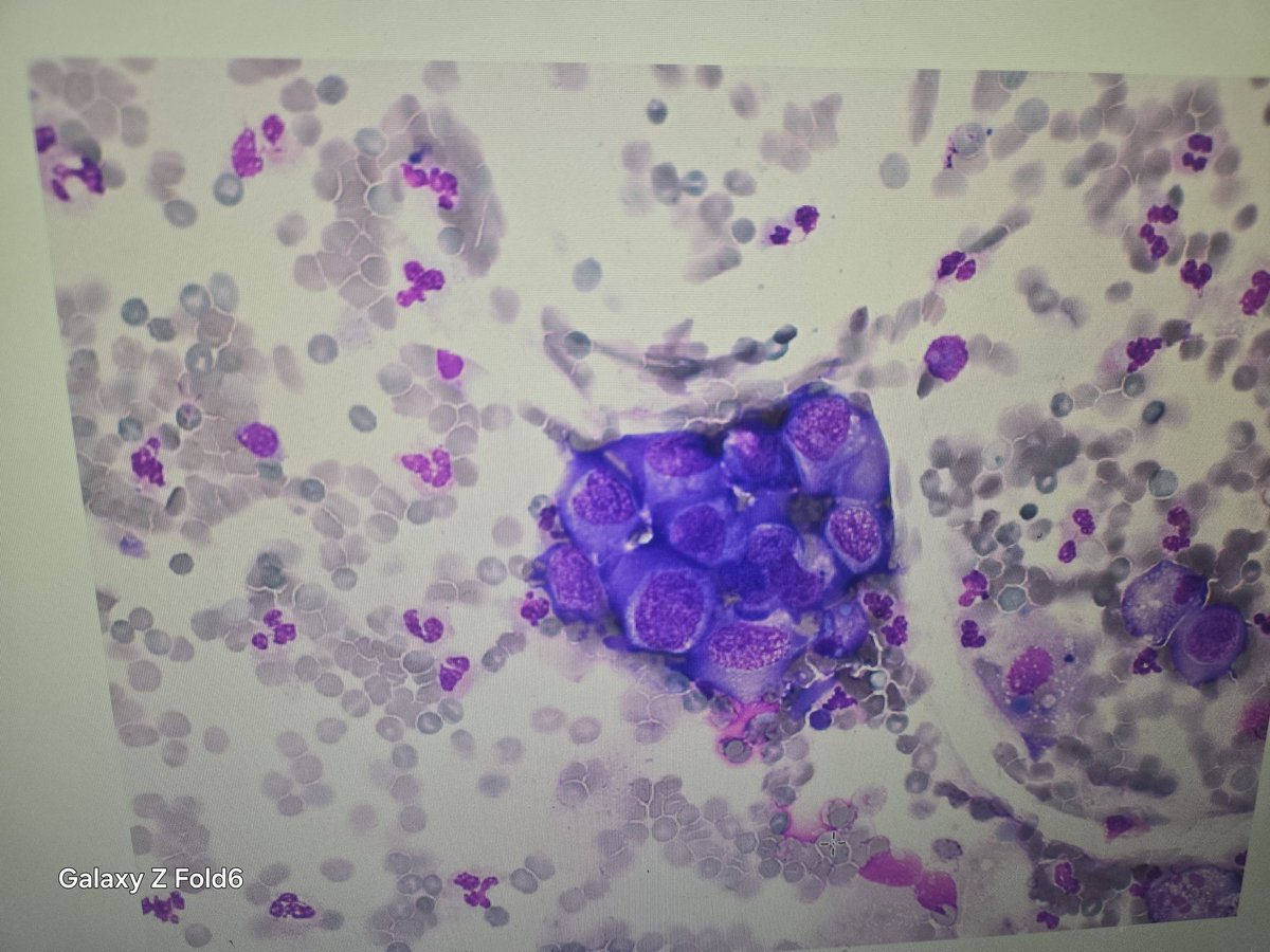 癌細胞元気に増殖しとる！
まいったな。なう。