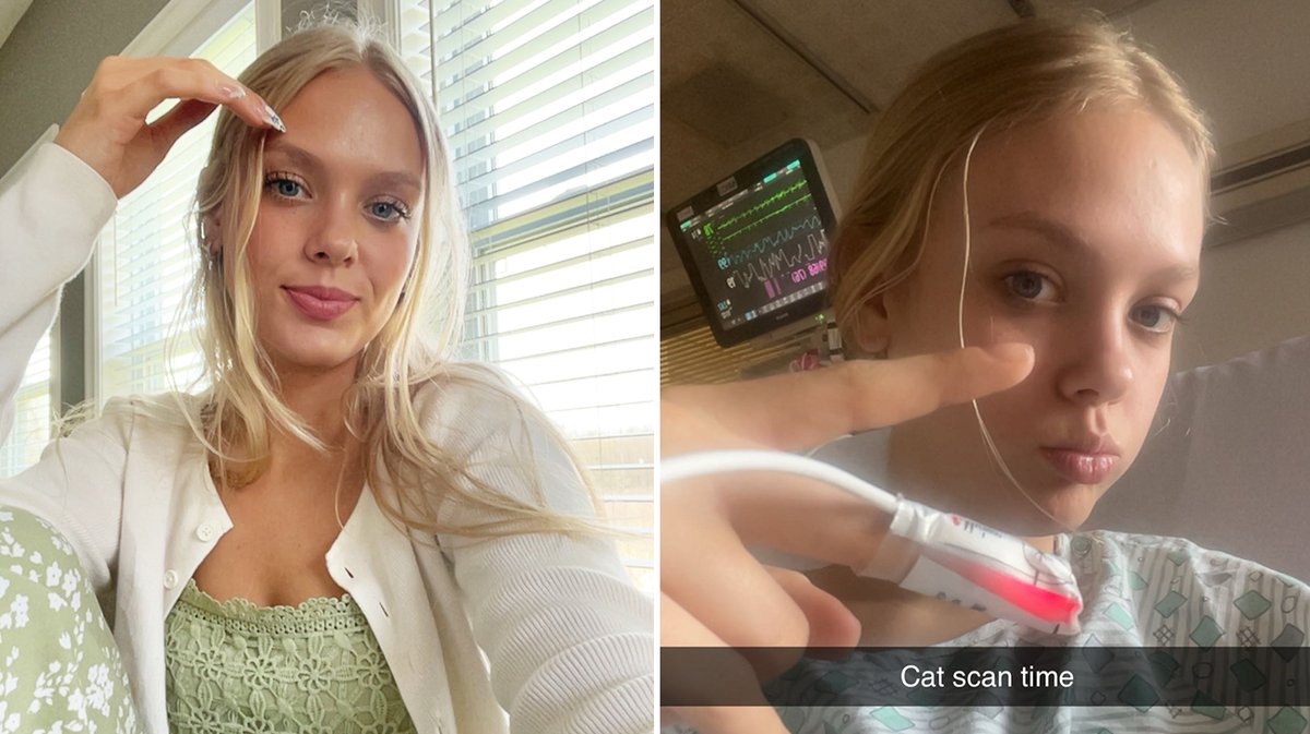 First, Lexi began losing control of the left side of her body. 
Then a friend noticed her face drooping from a photo shared on social media.
At 18 years old, Lexi was experiencing a stroke.
Quick action made all the difference. #StrokeMonth
More: cle.clinic/3FdpPu7