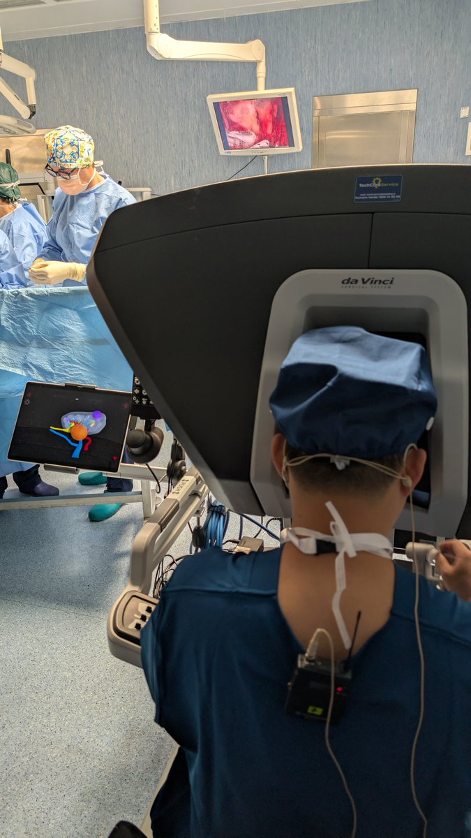 Achille Aveta (@drachilleaveta) on Twitter photo Congratulations to <a href="/wuzhenjie17/">Zhenjie Wu, MD, PhD</a> for successfully performing a retroperitoneal partial nephrectomy with remarkable precision and skill. An excellent demonstration of minimally invasive surgery!!#Synergy ⚕️ Congratulations to <a href="/wuzhenjie17/">Zhenjie Wu, MD, PhD</a> for successfully performing a retroperitoneal partial nephrectomy with remarkable precision and skill. An excellent demonstration of minimally invasive surgery!!#Synergy ⚕️