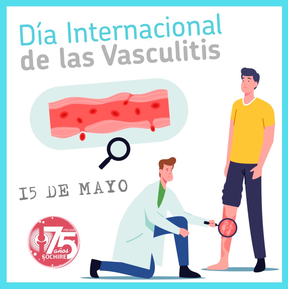 La vasculitis es una inflamación de los vasos sanguíneos que puede afectar órganos vitales impactando la calidad de vida de los pacientes. En su día internacional, alzamos la voz por quienes la padecen. Conocerla es el primer paso para apoyar. #vasculitis