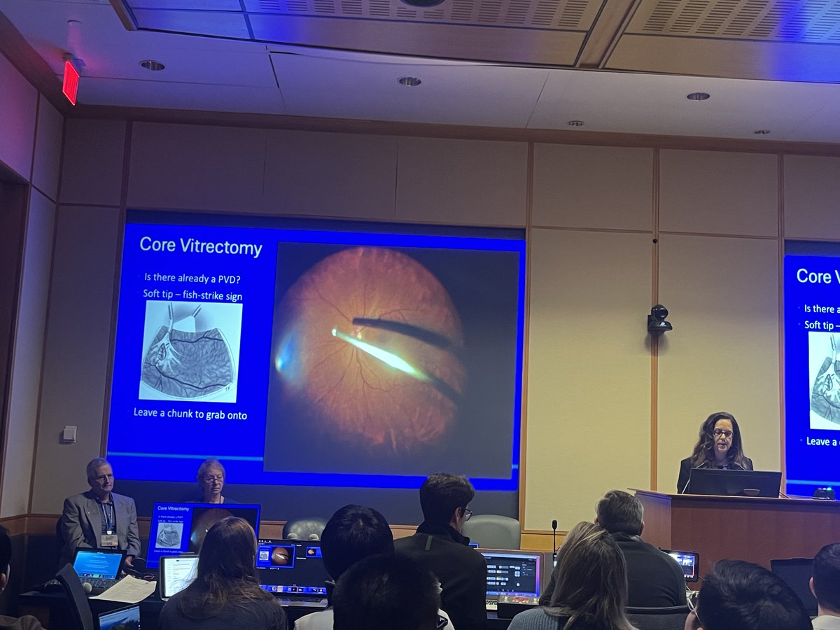 Retina Today (@retinatoday) on Twitter photo Sharon Fekrat, MD, provided important pearls for budding VR surgeons, including cannula insertion, infusion line tips, core vitrectomy (is there a PVD??), visualization, etc. <a href="/dukeeyecenter/">Duke Eye Center</a> <a href="/YoungMDConnect/">YoungMD Connect</a> <a href="/DukeMedSchool/">Duke University School of Medicine</a> #retina #fAVS2025 Sharon Fekrat, MD, provided important pearls for budding VR surgeons, including cannula insertion, infusion line tips, core vitrectomy (is there a PVD??), visualization, etc. <a href="/dukeeyecenter/">Duke Eye Center</a> <a href="/YoungMDConnect/">YoungMD Connect</a> <a href="/DukeMedSchool/">Duke University School of Medicine</a> #retina #fAVS2025
