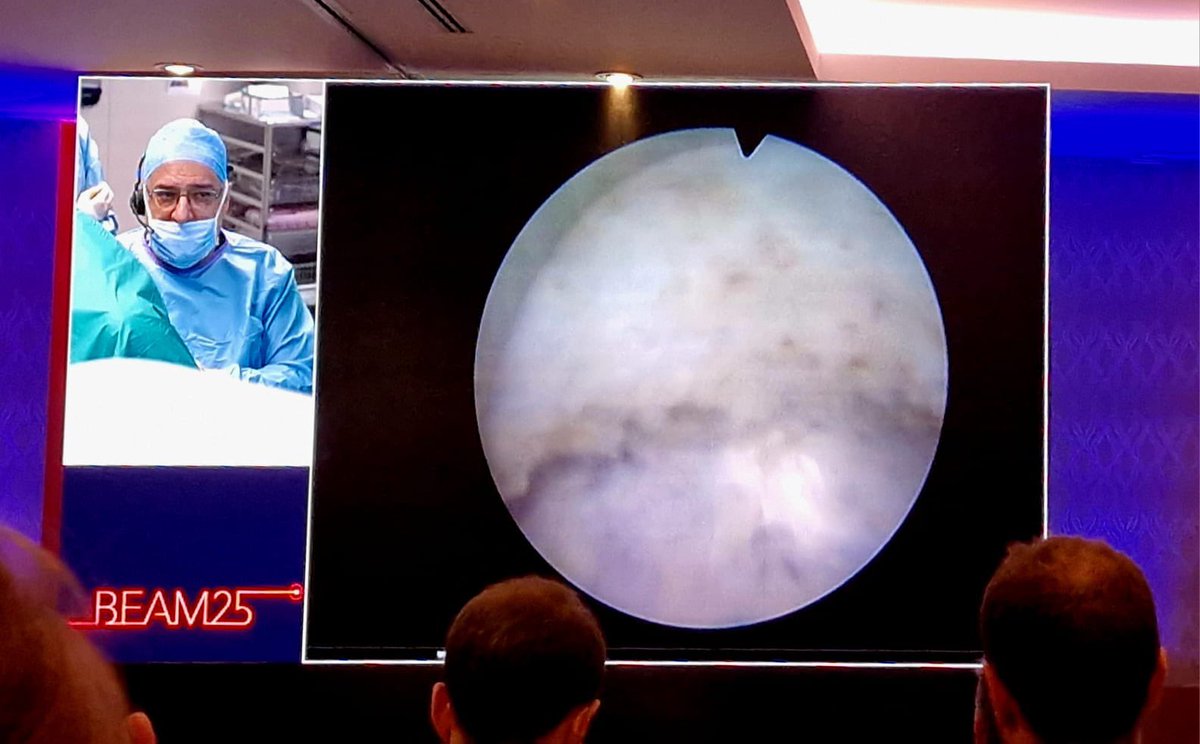 quanta_system's tweet image. #beam25 - Day 1️⃣

🙏 Special thanks to Dr. @fgomsan for the #LiveSurgery #HoLEP performed with #CyberHo150 and #QuantaMagnetoTechnology🧲

#UrologyInnovation #QuantaSystem #bequanta