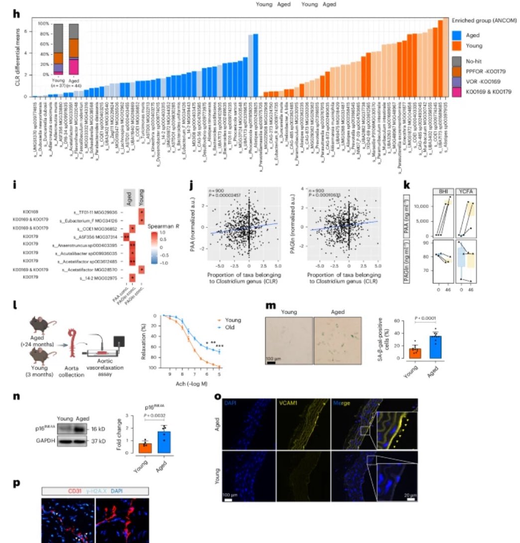 CTEC - Zurich University Heart Center (@ctecresearch) on Twitter photo 📣We are thrilled to highlight a major breakthrough from the #Saeedi_Lab now published in <a href="/NatureAging/">Nature Aging</a>. This pioneering study provides the 1️⃣st causal evidence linking gut microbial metabolism to vascular aging.📚
Read the full paper here nature.com/articles/s4358…
<a href="/SoheilSaeedi5/">Soheil Saeedi</a> 📣We are thrilled to highlight a major breakthrough from the #Saeedi_Lab now published in <a href="/NatureAging/">Nature Aging</a>. This pioneering study provides the 1️⃣st causal evidence linking gut microbial metabolism to vascular aging.📚
Read the full paper here nature.com/articles/s4358…
<a href="/SoheilSaeedi5/">Soheil Saeedi</a>