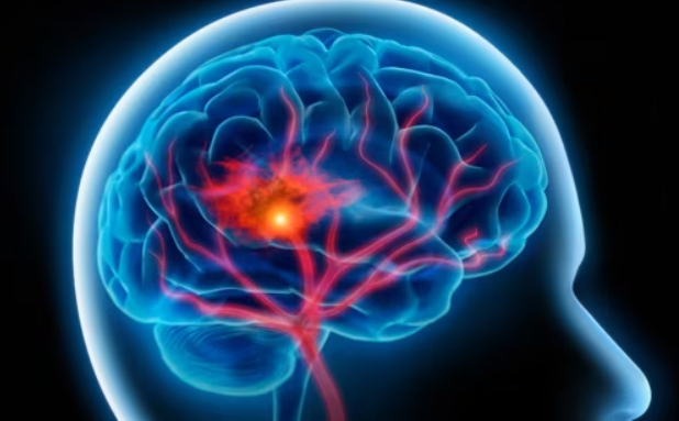 🧠 “We must do better at recognising MS early.”

In this #WorldMSDay interview, Dr Lisa Doggett shares her dual perspective as a physician &amp; patient, highlighting the importance of early MS diagnosis &amp; education

👉 touchneurology.com/insight/recogn…

@MSSociety #MultipleSclerosis #MS #NMSS