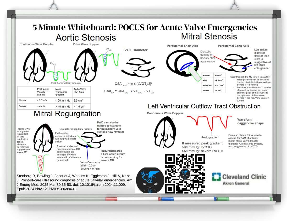 Take a look at this #Sonogames25 Round 0 submission from <a href="/RubberCitySono/">Rubber City Sono</a> 

#CCAG #RubberCitySono #ClevelandClinic #AkronGeneral #SAEM25 <a href="/SAEMonline/">SAEM</a>