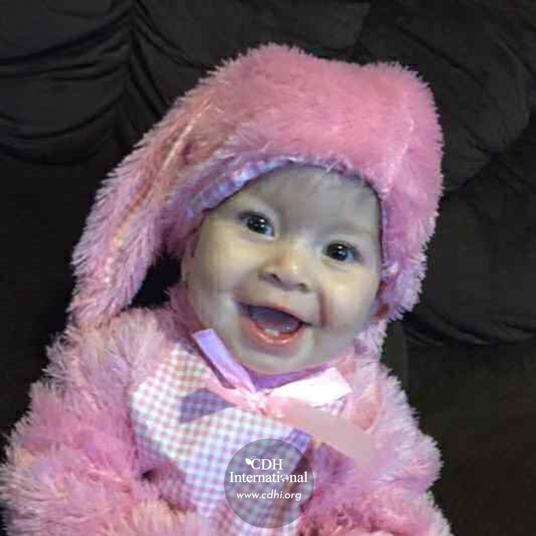 The Faces of Congenital Diaphragmatic Hernia

cdhi.org

#CDH #CDHAwareness #NotJustAHole #CongenitalDiaphragmaticHernia #CDHAwarenessMonth #April19 #CDHCharity #PediatricSurgery #GlobalSurgery #RareDisease #PatientAdvocacy #Donate