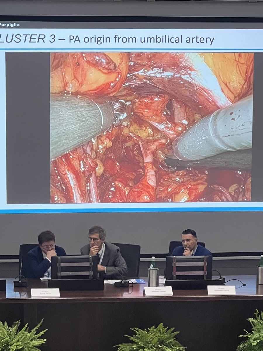 Symp for Multidisciplinar Advancement in UroOnco (@synergy_uro) on Twitter photo LIVE from SYNERGY 🔹
Prof. Francesco Porpiglia <a href="/PorpigliaF/">Porpiglia Francesco</a> is now on stage presenting the Early Prostatic Artery Control (EPAC) technique — a revolutionary step forward in the field of prostate surgery.
A must-see moment for all attending! LIVE from SYNERGY 🔹
Prof. Francesco Porpiglia <a href="/PorpigliaF/">Porpiglia Francesco</a> is now on stage presenting the Early Prostatic Artery Control (EPAC) technique — a revolutionary step forward in the field of prostate surgery.
A must-see moment for all attending!