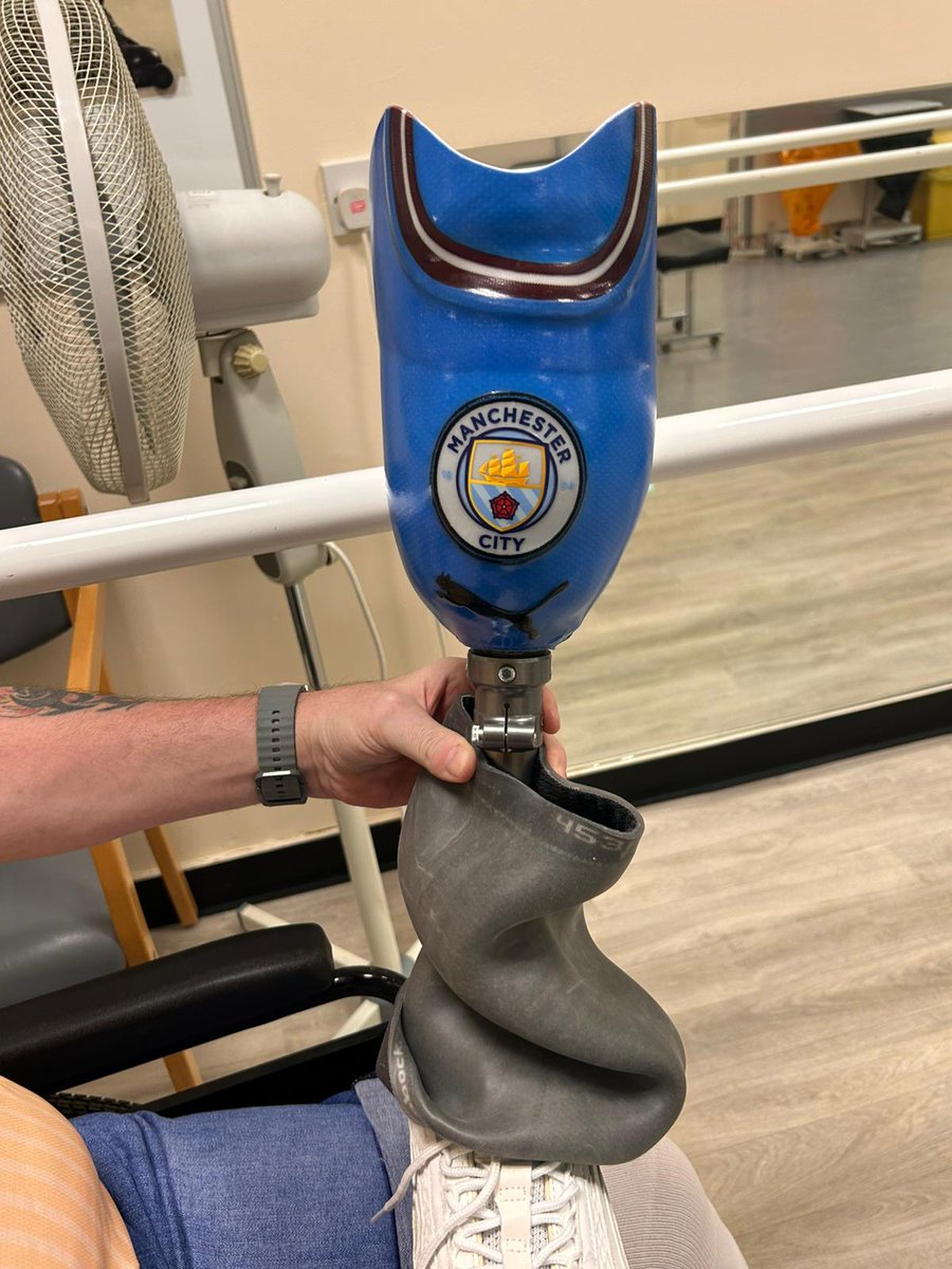 Got my new <a href="/ManCity/">Manchester City</a> leg fitted today, spent an hour practicing, just got to get used to it with more and more experience, they took my Colin Bell tribute shirt and laminated it to the prosthetic, I think they did a great job, my new life starts here and now #mcfc