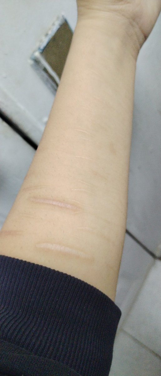 c0conutTsS's tweet photo. Extraño kortarme el brazo izquierdo pero ya no puedo porque me voy a tatuar ajajaaka https://t.co/za7eGgttU4