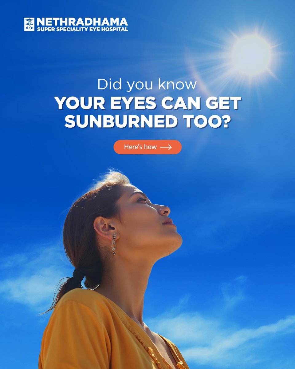 Nethradhama's tweet image. Have you heard about Photokeratitis? If not, it's important to know that overexposure to UV rays can cause this temporary but painful #EyeCondition. Essentially, sunburn for your Eyes!