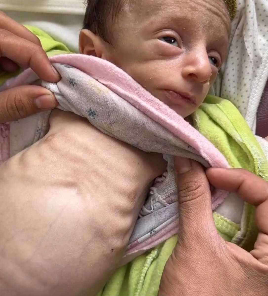 PLEASE DON'T SKIP ME :((

My account has been restricted, 
So, my gfm doesn't appear to everyone! 
Please support my family gfm !!!!
by sharing and quoting and donating 💔🙏🏻🚨

Please, Leave a comment 🇵🇸 or

gofund.me/760e5c7d