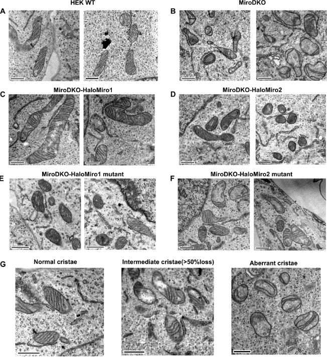J_Cell_Sci's tweet photo. Samruddhi Shembekar, Martin Bähler and colleagues interrogate the regulation of mitochondrial cristae organisation by Myo19, Miro1 and Miro2, and metaxin 3.
https://t.co/fSf3ETc3Uk
#JCSMitoSI #mitochondria #OpenAccess #ReadandPublish https://t.co/0afn7LO5q1