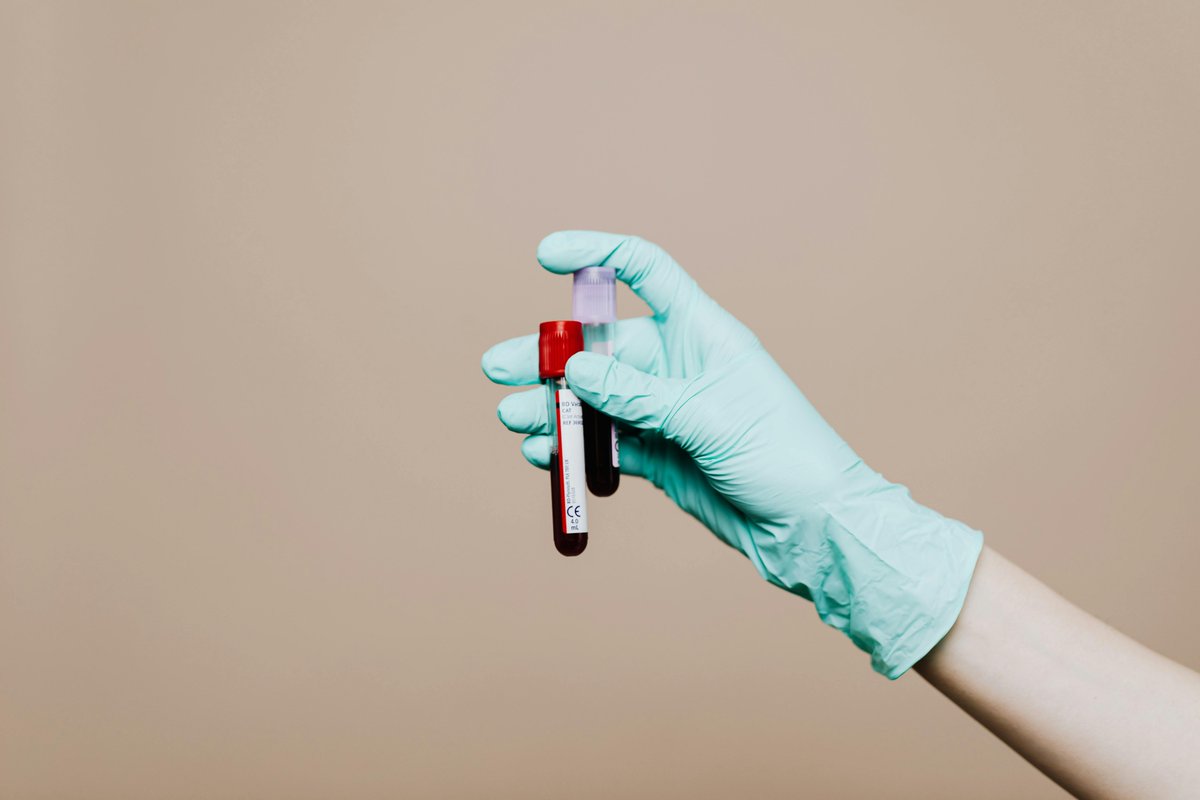 HPRU_EBS's tweet image. 🚨New blog🚨In 2022, to increase access to Blood-Borne Virus (BBV) testing in areas with very high #HIV prevalence, NHS England introduced routine opt-out testing for HIV & #Hepatitis B&C in emergency departments. Read more about optimising this method➡️ bit.ly/44oaUaJ