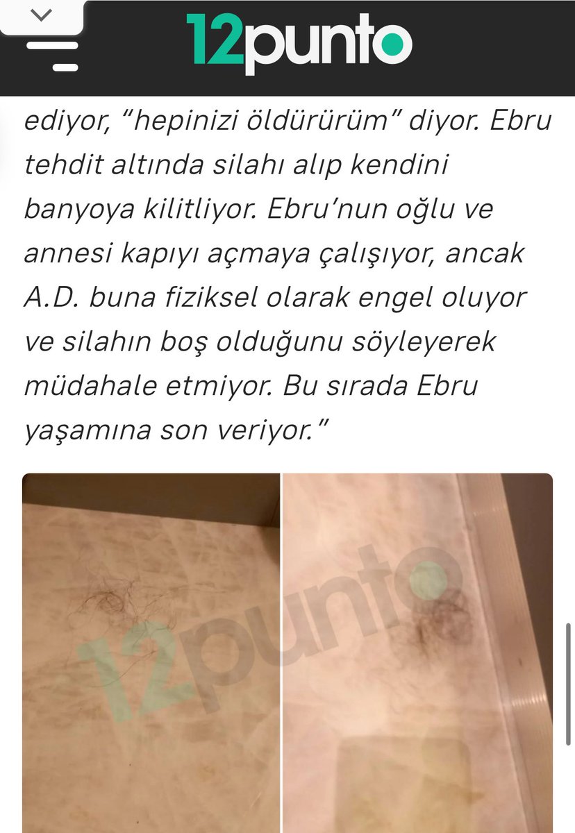 Bu gördüğünüz saçlar Ebru'nun yaşamını yitirdiği gün şiddetle kopartılan saçları!

❗️Ebru 13 yıl boyunca şiddete maruz bırakıldı ve 20 Kasım 2024 tarihinde yaşamına son verdi!

❗️Savcılık onca kanıta rağmen Ebru'ya şiddet uygulayan A.D. hakkında "intihara yönlendirme" suçundan