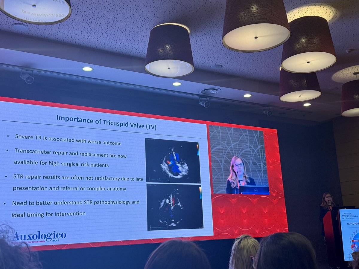 Alexandra Clement (@clementa25) on Twitter photo The tricuspid valve takes center stage at the Spring Conference of the Romanian Society of Cardiology.
Insightful presentation from <a href="/denisamuraru/">Denisa Muraru</a>
<a href="/bogdan_popescu1/">Bogdan A. Popescu</a> <a href="/DonalErwan/">Donal</a> The tricuspid valve takes center stage at the Spring Conference of the Romanian Society of Cardiology.
Insightful presentation from <a href="/denisamuraru/">Denisa Muraru</a>
<a href="/bogdan_popescu1/">Bogdan A. Popescu</a> <a href="/DonalErwan/">Donal</a>