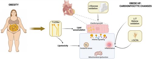 Diego Segura-Rodríguez (@seguracardio) on Twitter photo #Obesity in👥 with #HeartFailure: a common challenge & a therapeutic target in #HFpEF.
New #ESC_HFA Scientific 📝‼️
#PositionPaper #HF <a href="/escardio/">European Society of Cardiology</a> #EHJHF #Obesity in👥 with #HeartFailure: a common challenge & a therapeutic target in #HFpEF.
New #ESC_HFA Scientific 📝‼️
#PositionPaper #HF <a href="/escardio/">European Society of Cardiology</a> #EHJHF