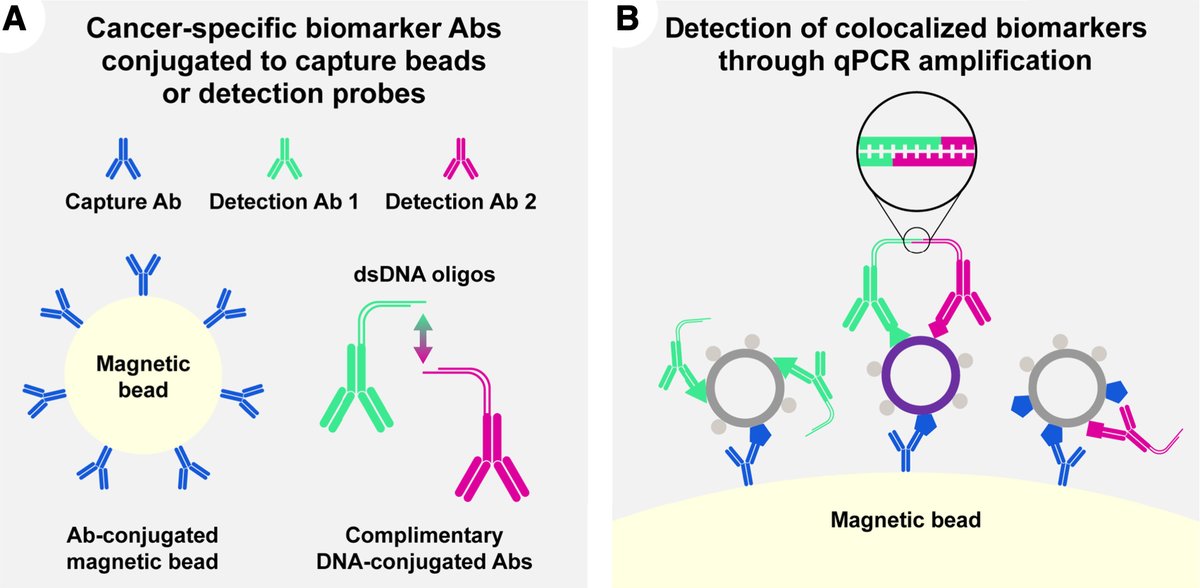 Association for Molecular Pathology (@ampath) on Twitter photo On this #WorldOvarianCancerDay, we wanted to bring this recent paper in <a href="/JMDiagn/">The Journal of Molecular Diagnostics</a> to your attention: "Improving Specificity for Ovarian Cancer Screening Using a Novel Extracellular Vesicle–Based Blood Test" 🔗 jmdjournal.org/article/S1525-… #OpenAccess On this #WorldOvarianCancerDay, we wanted to bring this recent paper in <a href="/JMDiagn/">The Journal of Molecular Diagnostics</a> to your attention: "Improving Specificity for Ovarian Cancer Screening Using a Novel Extracellular Vesicle–Based Blood Test" 🔗 jmdjournal.org/article/S1525-… #OpenAccess