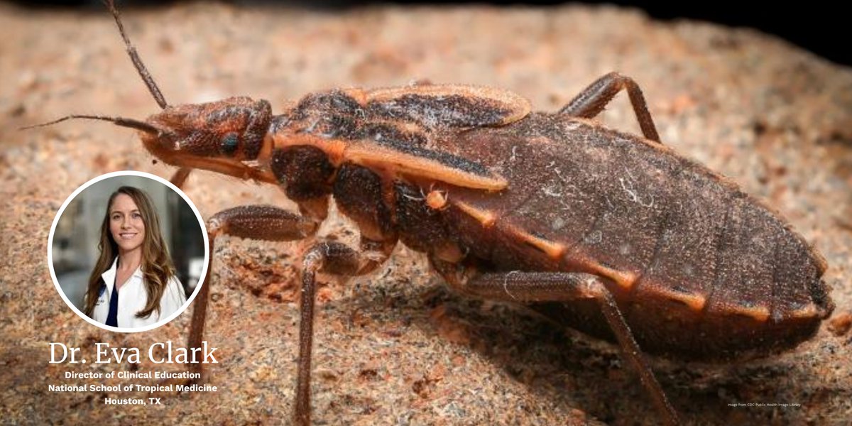 BCM Clinician Resources (@bcmcme) on Twitter photo Should you be worried about the kissing bug?
Learn more from Chagas disease expert <a href="/EvaClarkMD/">Eva Clark</a> : bit.ly/3GGK4kt
<a href="/BCMDeptMedicine/">BCM Department of Medicine</a> <a href="/ASTMH/">ASTMH</a> <a href="/JillWeather/">Jill Weatherhead, MD, PhD</a> <a href="/mebottazzi/">Maria Elena Bottazzi</a> <a href="/Women_in_ID/">Women In Infectious Diseases (WIID)</a> <a href="/WiParasitology/">Women In Parasitology</a> <a href="/BCM_TropMed/">BCM_TropMed</a> <a href="/PeterHotez/">Prof Peter Hotez MD PhD</a> Should you be worried about the kissing bug?
Learn more from Chagas disease expert <a href="/EvaClarkMD/">Eva Clark</a> : bit.ly/3GGK4kt
<a href="/BCMDeptMedicine/">BCM Department of Medicine</a> <a href="/ASTMH/">ASTMH</a> <a href="/JillWeather/">Jill Weatherhead, MD, PhD</a> <a href="/mebottazzi/">Maria Elena Bottazzi</a> <a href="/Women_in_ID/">Women In Infectious Diseases (WIID)</a> <a href="/WiParasitology/">Women In Parasitology</a> <a href="/BCM_TropMed/">BCM_TropMed</a> <a href="/PeterHotez/">Prof Peter Hotez MD PhD</a>