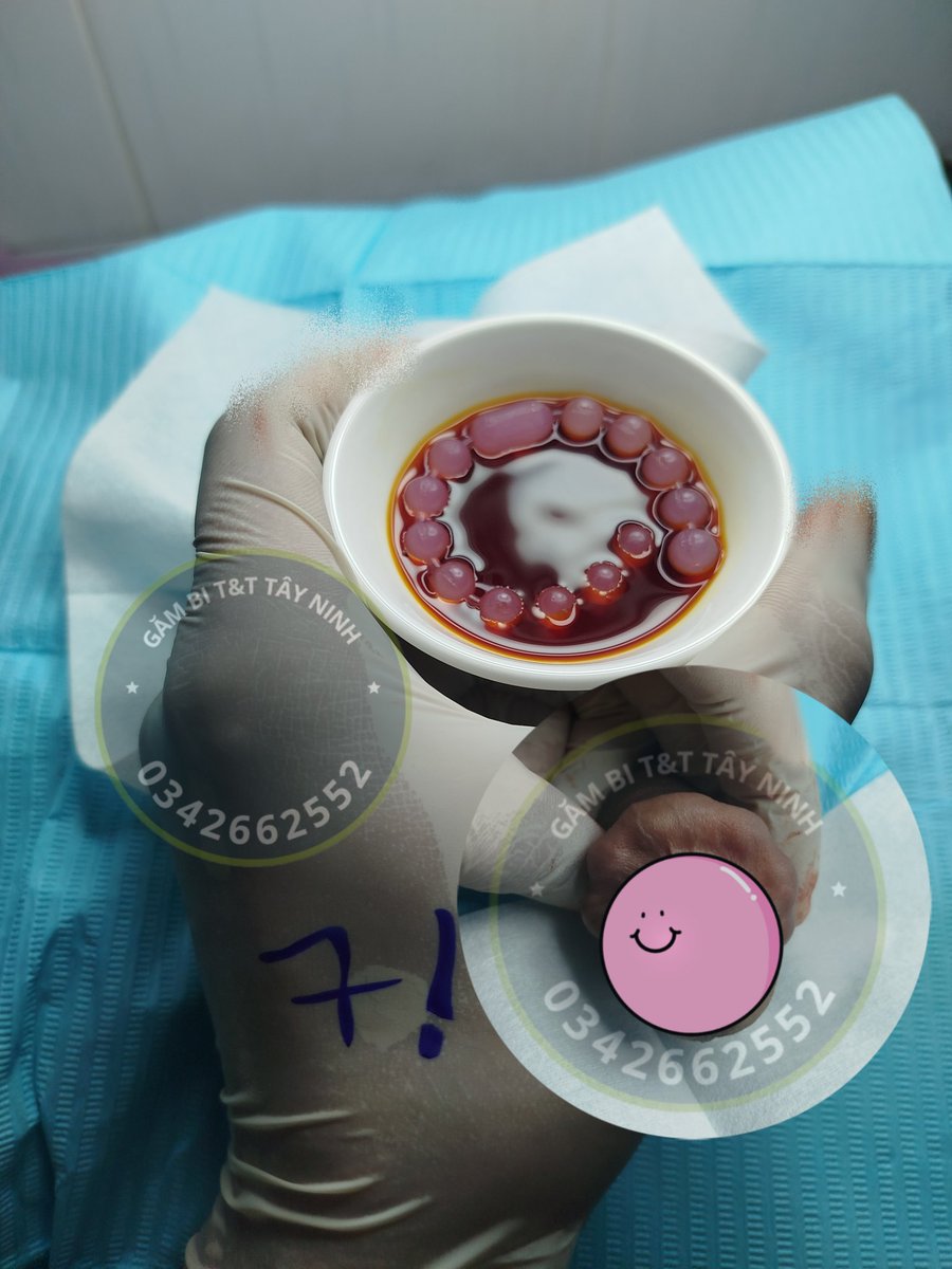 Chuỗi vòng 8mm 9 viên có viên lục giữa cho khách 🥰 
@