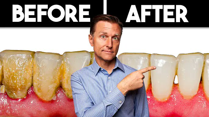 You brush. You floss. Yet your teeth keep developing plaque and decaying.

Is your mouthwash quietly DESTROYING your dental health?

Here’s what’s really damaging your teeth—and how to stop it now: 🧵