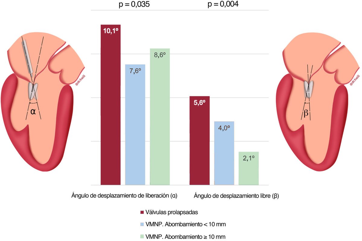 REC Publications (@revespcardiol) on Twitter photo Predictibilidad y tilting de dispositivo en la reparación mitral de borde a borde #REC #AheadOfPrint @chpedroli <a href="/AsmaratsL/">Lluis Asmarats</a> <a href="/amassovr/">Albert Massó van Roessel</a> <a href="/icsMillan/">Xavier Millán</a> <a href="/StructuralBCN/">Dabit Arzamendi</a> revespcardiol.org/es-predictibil… Predictibilidad y tilting de dispositivo en la reparación mitral de borde a borde #REC #AheadOfPrint @chpedroli <a href="/AsmaratsL/">Lluis Asmarats</a> <a href="/amassovr/">Albert Massó van Roessel</a> <a href="/icsMillan/">Xavier Millán</a> <a href="/StructuralBCN/">Dabit Arzamendi</a> revespcardiol.org/es-predictibil…