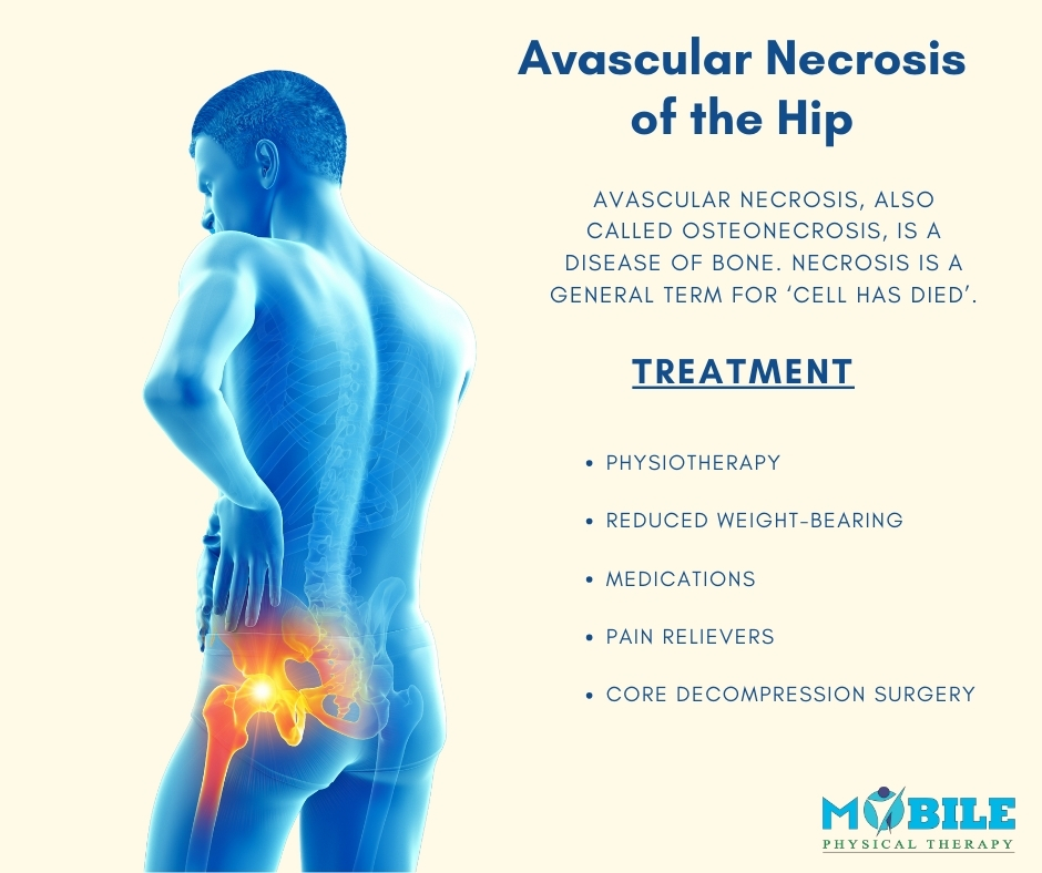 Physiotherapy65's tweet photo. Avascular Necrosis (AVN) of the hip can cause pain, stiffness, and limited mobility. Early physiotherapy can help manage symptoms and improve quality of life. Book your home visit today!
#AVN #HipPain #PhysiotherapyAtHome #MobilePhysio #MoveBetterLiveBetter https://t.co/71yPNPLMbL