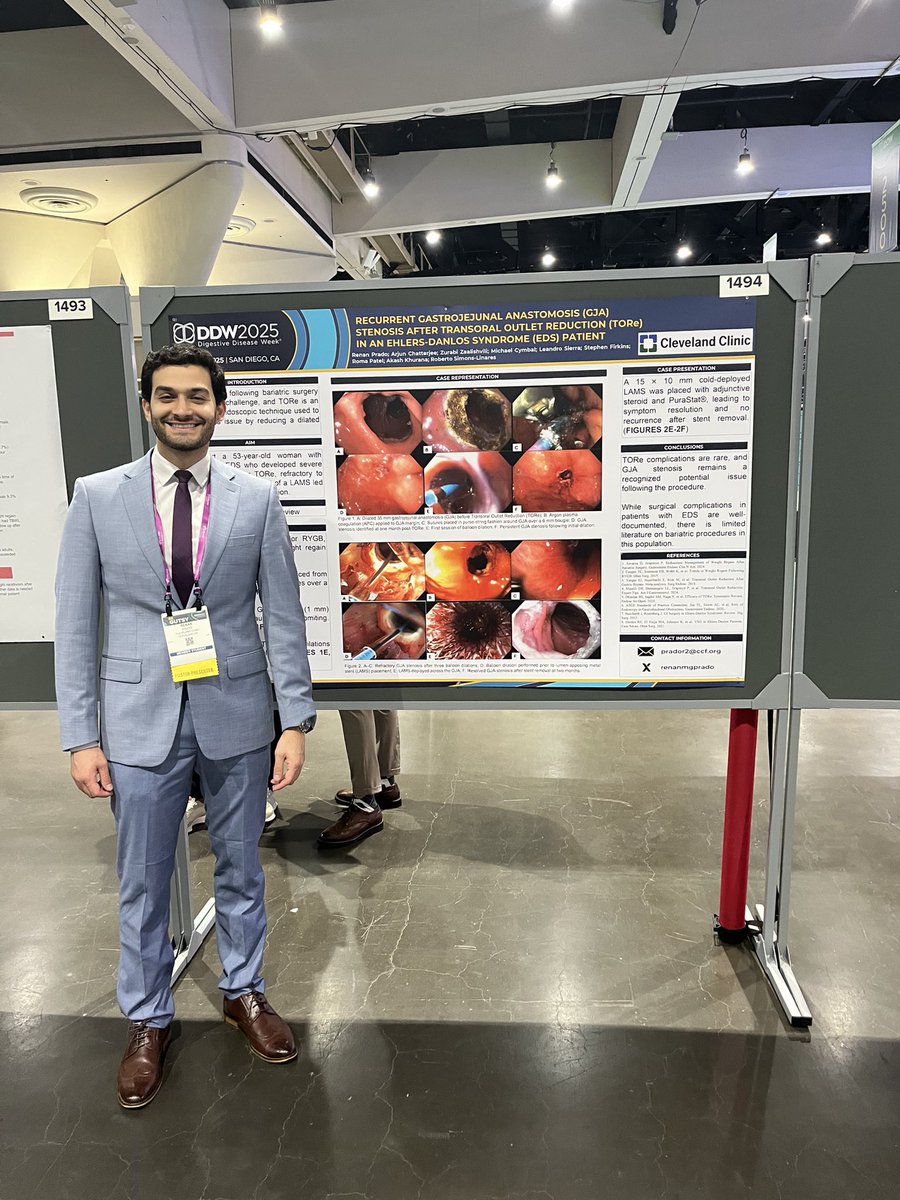 Just wrapped up my first #DDW25 and it was an incredible experience! 
Presented 3 posters and contributed to 7 more oral/poster presentations. 
Grateful for the opportunity to share and learn!! 
Loved connecting with so many inspiring colleagues and mentors