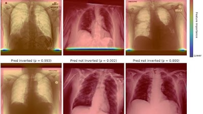 Radiology: Artificial Intelligence (@radiology_ai) on Twitter photo <a href="/JWeirMcCall/">Jonathan Weir-McCall</a> <a href="/radiology_UOC/">Department of Radiology, University of Cambridge</a> present a suite of QC tools for chest x-rays based on traditional and #AI methods, developed & tested with data from 39 centers in 7 countries doi.org/10.1148/ryai.2… <a href="/lorena_e_s/">Lorena Escudero Sánchez</a> <a href="/FacultyMaths/">Faculty of Mathematics - University of Cambridge</a> <a href="/KingsCollegeLon/">King's College London</a> #CXR #QualityControl #MachineLearning <a href="/JWeirMcCall/">Jonathan Weir-McCall</a> <a href="/radiology_UOC/">Department of Radiology, University of Cambridge</a> present a suite of QC tools for chest x-rays based on traditional and #AI methods, developed & tested with data from 39 centers in 7 countries doi.org/10.1148/ryai.2… <a href="/lorena_e_s/">Lorena Escudero Sánchez</a> <a href="/FacultyMaths/">Faculty of Mathematics - University of Cambridge</a> <a href="/KingsCollegeLon/">King's College London</a> #CXR #QualityControl #MachineLearning