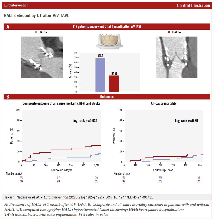 EuroInterventio's tweet photo. In this paper Nagasaka et al. showed that HALT at 1 month after ViV TAVI predicts a higher 3-year risk of death, stroke, or HF hospitalization.
Undersized THV expansion and absence of anticoagulation were key predictors.
https://t.co/QNWgPLJj6Z
#TAVI #CTImaging #ValveThrombosis https://t.co/M7ySYm3iBQ