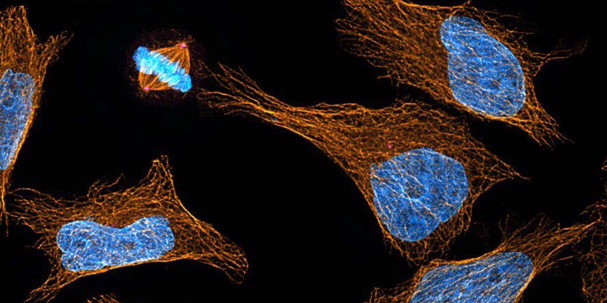 What diffraction limit? 🔬 🚀  

If you're looking to image subcellular detail at super-resolution look no further than the Network Biology Collaborative Centre! Our expert staff will help you acquire images with up to 30 nm resolution! 

Get in touch ➡️  bit.ly/4fzgXM9
