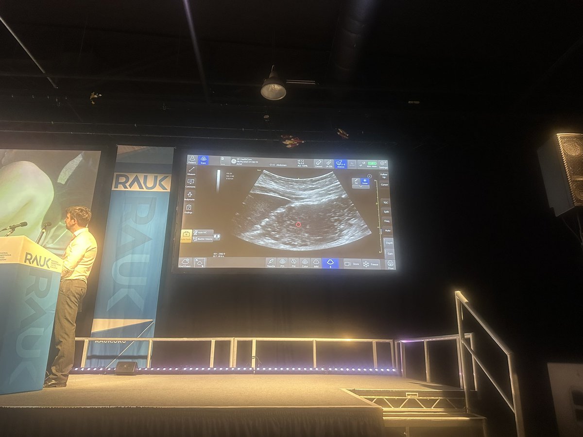 Alan Macfarlane (@ajrmacfarlane) on Twitter photo <a href="/rosie_hogg/">Rosie Hogg</a> discussing the GLP-1 agonists and doing the live gastric scanning demo #RAUK25 incl before and after water <a href="/rosie_hogg/">Rosie Hogg</a> discussing the GLP-1 agonists and doing the live gastric scanning demo #RAUK25 incl before and after water