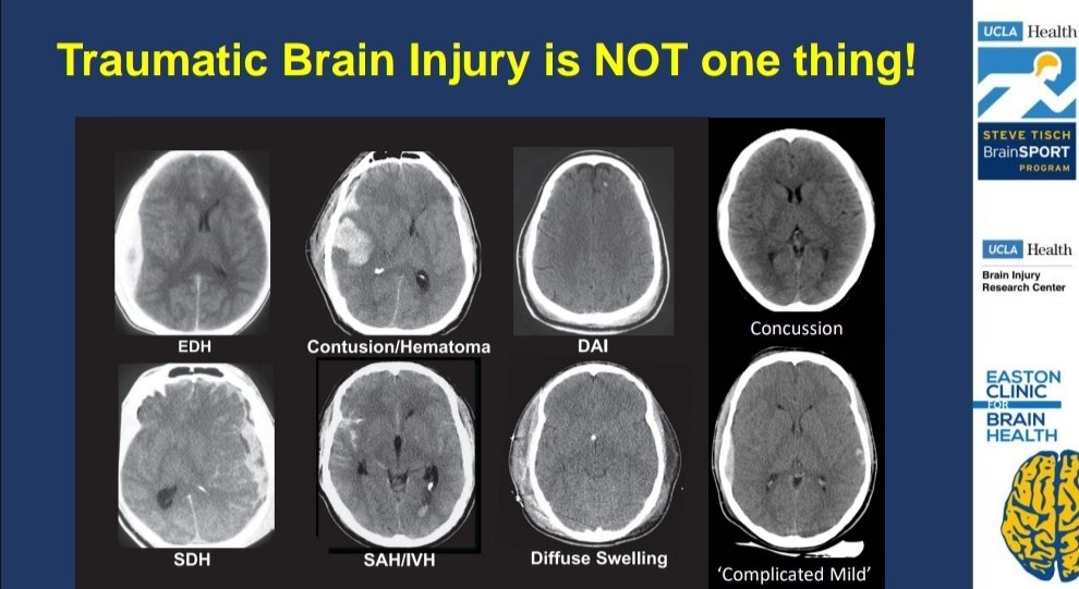 Chris Giza (@griz1) on Twitter photo Excited to lead day 2 #WFNR2025 #WorldFederationOfNeuroRehab <a href="/WFNRehab/">WFNR</a> with a morning of #Pediatrics! Stop treating #TBI like a single diagnosis. Uncover biological endotype of injury & treat that! <a href="/uclachildneuro/">UCLA Pediatric Neurology</a> <a href="/ChildNeuroSoc/">Child Neurology Society</a> <a href="/icnapedia/">ICNApedia</a> <a href="/Neurotrauma/">NeurotraumaSociety</a> <a href="/UCLABrainSPORT/">UCLA Steve Tisch BrainSPORT Program</a> #SARAHRehab Excited to lead day 2 #WFNR2025 #WorldFederationOfNeuroRehab <a href="/WFNRehab/">WFNR</a> with a morning of #Pediatrics! Stop treating #TBI like a single diagnosis. Uncover biological endotype of injury & treat that! <a href="/uclachildneuro/">UCLA Pediatric Neurology</a> <a href="/ChildNeuroSoc/">Child Neurology Society</a> <a href="/icnapedia/">ICNApedia</a> <a href="/Neurotrauma/">NeurotraumaSociety</a> <a href="/UCLABrainSPORT/">UCLA Steve Tisch BrainSPORT Program</a> #SARAHRehab