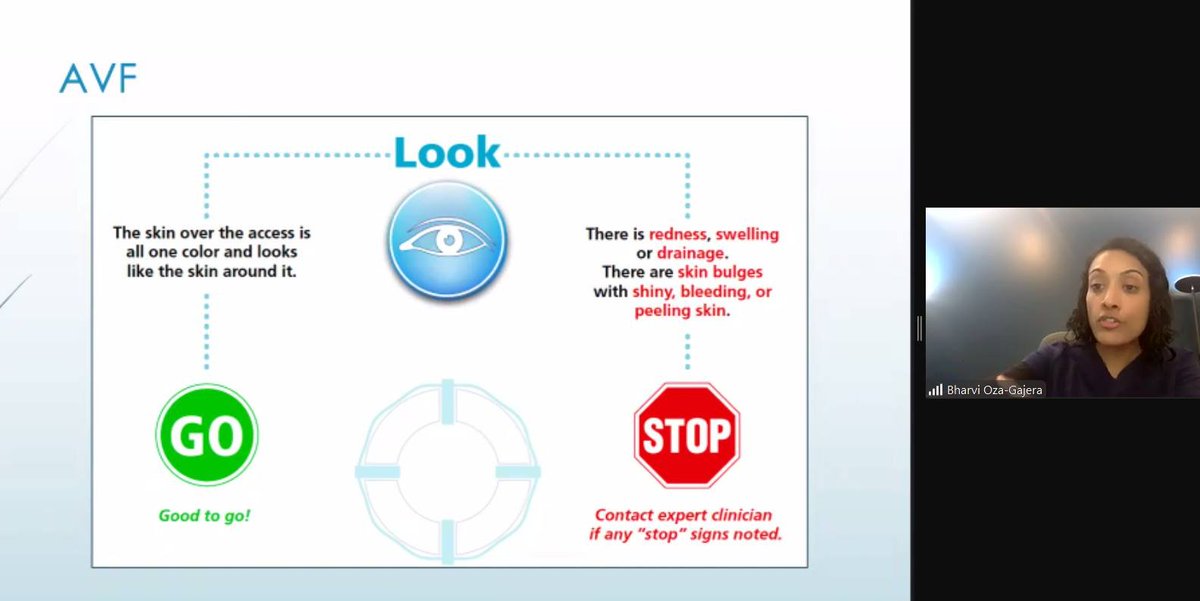 Dr. Bharvi Oza-Gajera great presentation ASDIN webinar on vascular access monitoring for AV fistulae, AV grafts, and hemodialysis catheters. Very important for nurses in dialisys units.
Thank you <a href="/ASDINNews/">ASDIN</a> 
<a href="/VASAMD/">VASA</a> <a href="/Dialysis_Access/">CiDA</a> <a href="/ANNAnurses/">ANNA</a> <a href="/SLANH_/">SLANH</a>