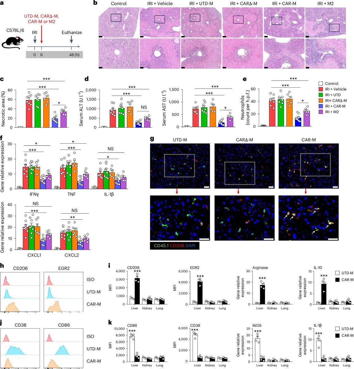 Waggoner Lab (@labwaggoner) on Twitter photo Targeting inflammation with CAR-macrophages using a signal switch <a href="/natBME/">Nature Biomedical Engineering</a>
nature.com/articles/s4155… Targeting inflammation with CAR-macrophages using a signal switch <a href="/natBME/">Nature Biomedical Engineering</a>
nature.com/articles/s4155…