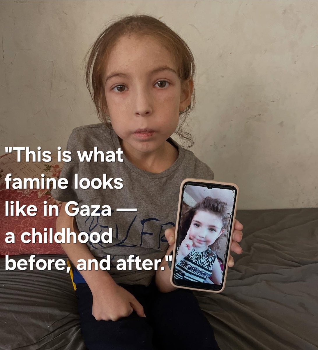 This is not just another photo.
This is a child in #Gaza — starving, holding up a picture of who she used to be.

Famine is no longer a looming threat. It’s here. It’s real. And it’s erasing childhoods before our eyes.