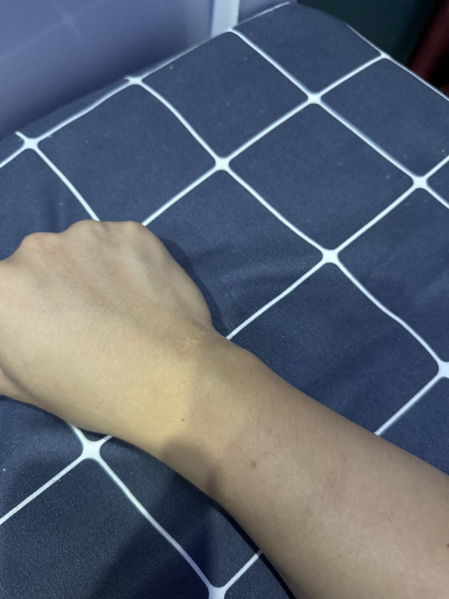 真当过兵的应该都会有这个疤吧，记得那时候下大雨，被连长叫出来在泥地里爬战术，把老子的水壶上的搭扣都给干飞一个🥲我比较菜，最快才爬了19秒😓