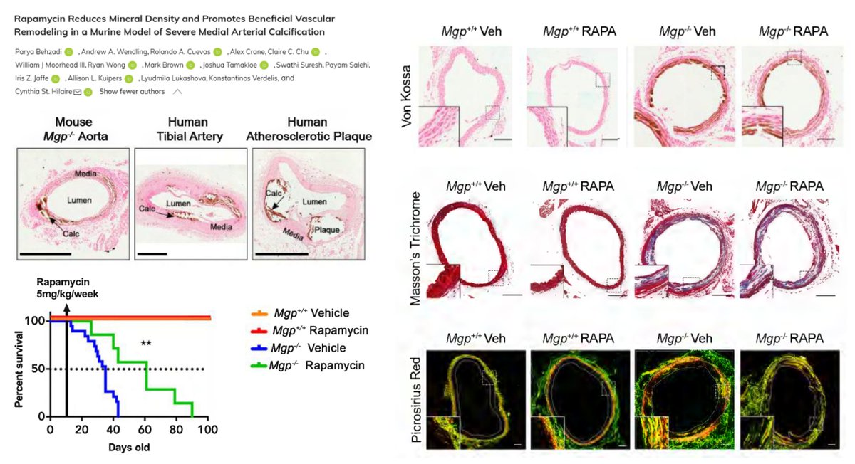 #Rapamycin #MedialArterialCalcification

Rapamycin (5 mg/kg, 3x/wk)⏫lifespan (T50 35➡️61 d) &amp; ⏬arterial mineral density, not calcified deposit volume, in Mgp-/-🐭

↔️Runx2
↔️Autophagic flux
⏫#SmoothMuscleCell contractile phenotype

Rapamycin benefits independently of mTORC2
