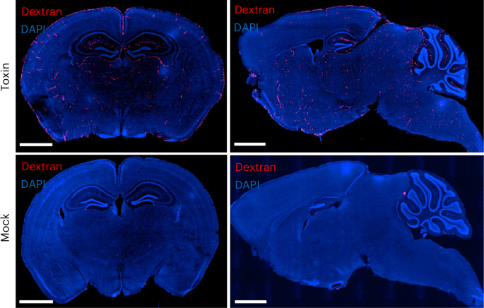 NatureMicrobiol's tweet image. Out Now! How Salmonella Typhi’s typhoid toxin causes encephalopathy bit.ly/3Z7CTb6 #Salmonella #Typhoid #Encephalopathy