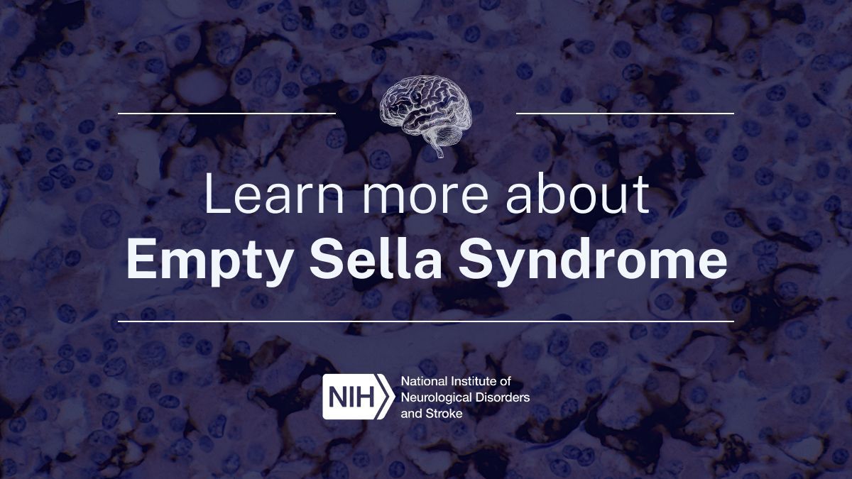 NINDS (@nih_ninds) on Twitter photo Have you heard of Empty Sella Syndrome (ESS)? It's a rare condition affecting the pituitary gland, which controls key hormones. Understanding rare conditions like ESS is part of our commitment at NINDS. 
Learn more: bit.ly/4jq84Xu Have you heard of Empty Sella Syndrome (ESS)? It's a rare condition affecting the pituitary gland, which controls key hormones. Understanding rare conditions like ESS is part of our commitment at NINDS. 
Learn more: bit.ly/4jq84Xu