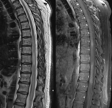 Daniel Gewolb, MD tweet media