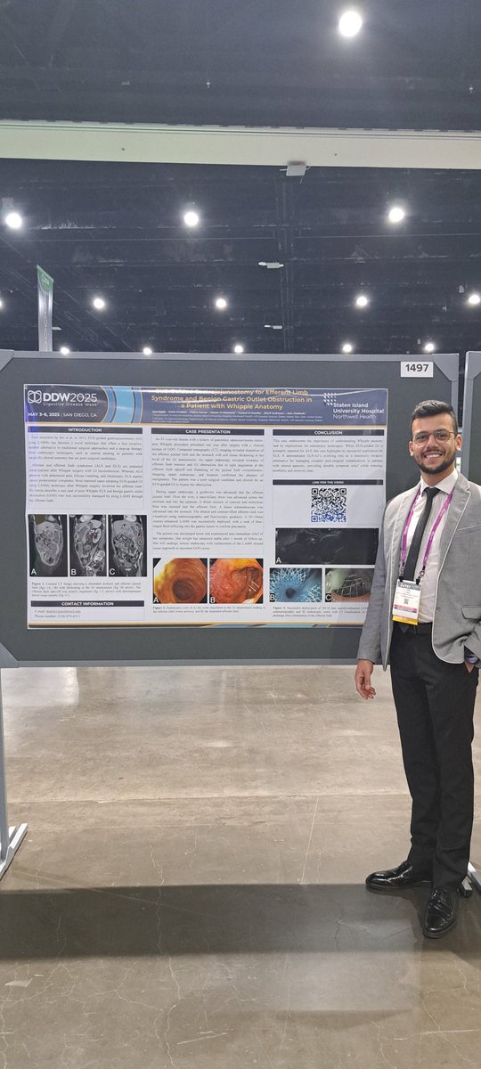 HabibToni's tweet photo. Had a great time at #DDW2025—always a GI calendar favorite! Grateful to present 3 posters on antibiotics before ERCP, a rare GJ anastomosis case, and GERD-lung cancer links. Huge thanks to the SIUH GI team for the mentorship and support! Inspired by so many in the field. https://t.co/KU7ABJjpHU