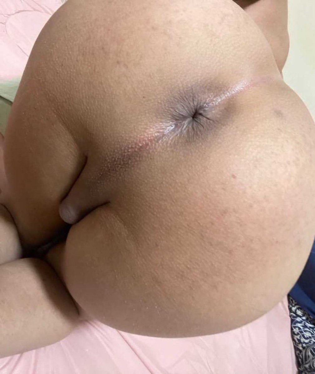 منو يطفي نارها