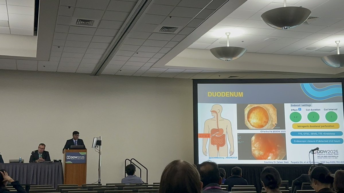 ibd_pal's tweet image. Prevention and management of IBD endoscopy complications @DDWMeeting #DDW2025 @ASGEendoscopy Interventional IBD SIG